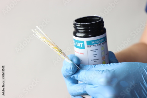 Professional wearing gloves holding a bottle of reagent strips for urinalysis  photo