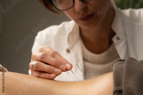 Acupunturist treating patient chronic back pain photo