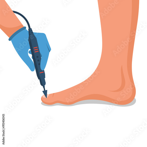 Podiatry concept. Feet treatment. Hardware medical pedicure. Nail cleaning apparatus. Patient on pedicure with pediatrician chiropodist. Clinic podology. Cosmetics of nails of legs. Vector design flat