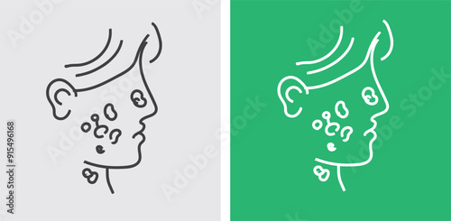 Skin Cancer Myths and Facts