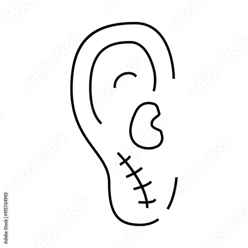 ear surgery line icon vector. ear surgery sign. isolated contour symbol black illustration