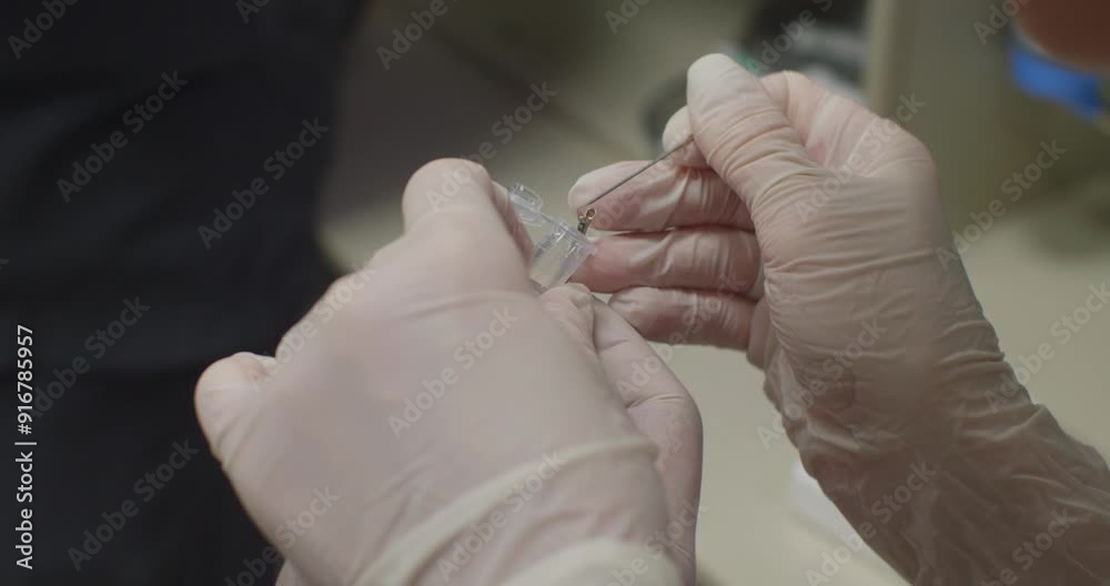 The doctor's gloved hands place a piece of biopsy into a jar of formalin. During the endoscopic examination, the doctor takes a tissue sample for histological examination.