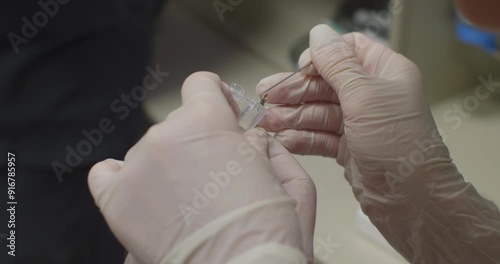 The doctor's gloved hands place a piece of biopsy into a jar of formalin. During the endoscopic examination, the doctor takes a tissue sample for histological examination.