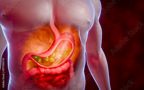 Symptoms of acid reflux or excess acid in the stomach. Gastric juice and intestinal model within the abdominal cavity. Burning sensation in the middle of the chest, acid reflux. 3D Rendering.