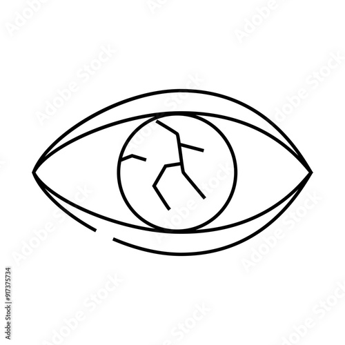 lens injury ophthalmology line icon vector. lens injury ophthalmology sign. isolated contour symbol black illustration