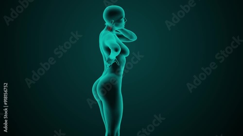 X-ray scan of the female cervical spine of a young adult woman with neck pain. Medically accurate 3D animation