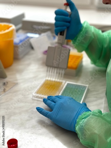 Elisa antibody test. Disease diagnostics. Enzyme-linked immunosorbent assay (ELISA) plate