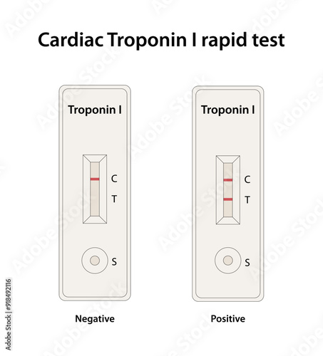 Cardiac Troponin I rapid test