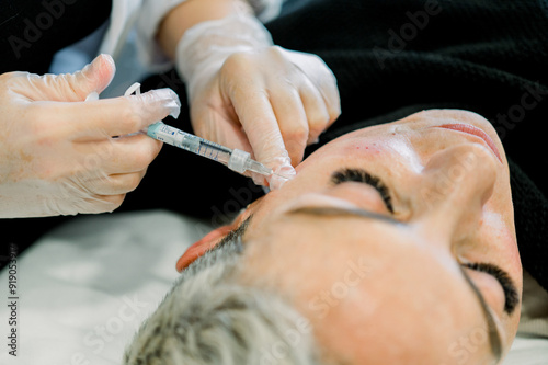 Cosmetic facial treatment with dermal fillers in clinic