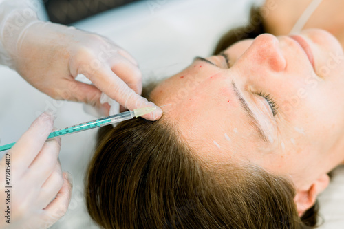 Cosmetic treatment with injections at an aesthetic clinic