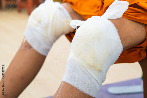 Obraz na płótnie Knee pain relief with herbal. Knee osteoarthritis. Thai traditional medicine w salonie