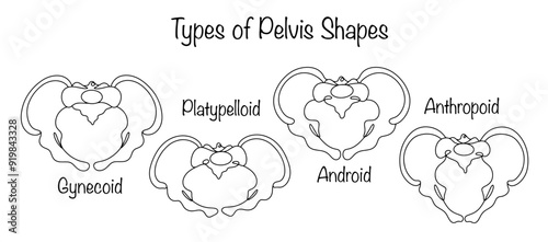Types of Pelvis Shapes