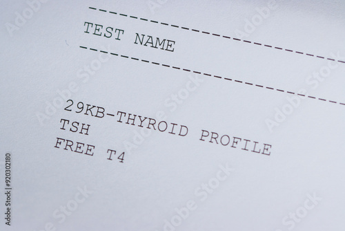 Thyroid profile test, thyroid stimulating hormone, TSH test and Thyroxine, Free T4 test on white paper.  photo