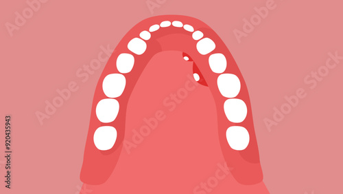 Mouth Sores, flat color illustration