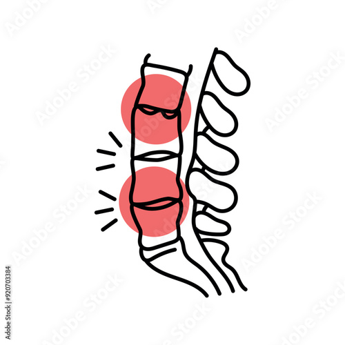 Ankylosing spondylitis color line icon. Diseases of the spine