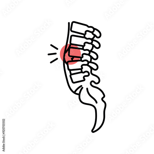 Osteomyelitis color line icon. Diseases of the spine