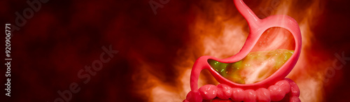 Фотография Symptoms of acid reflux or excess acid in the stomach