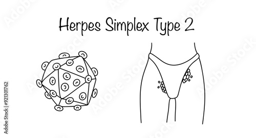Herpes Simplex Type 2