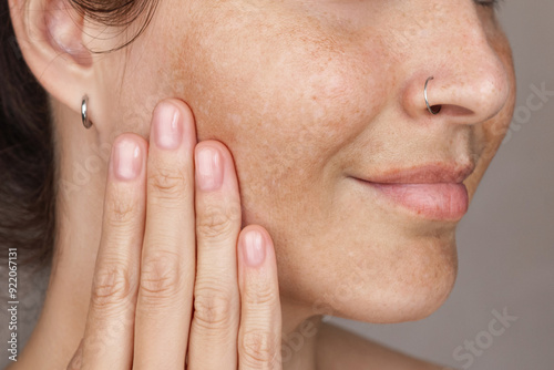 Cropped photo of caucasian woman's face with freckles or age spots photo. She loves her skin close up photo