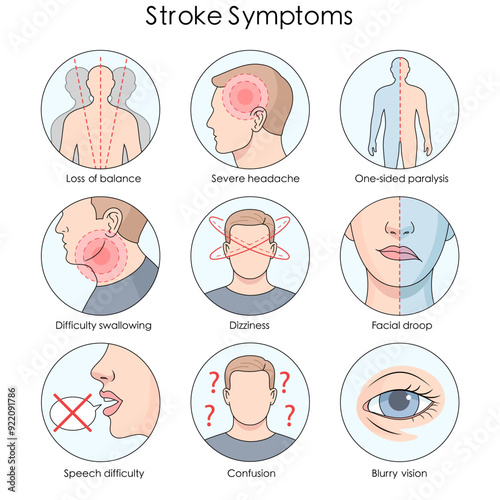 common stroke symptoms, dizziness, severe headache, facial droop, speech difficulty, and one-sided paralysis diagram hand drawn schematic vector illustration. Medical science educational illustration