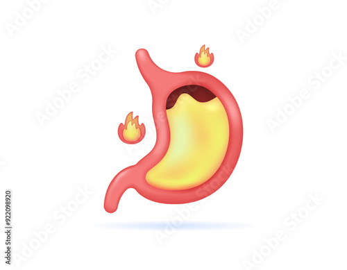 stomach acid rising. hot stomach or heartburn. GERD. illustration of the stomach organ and fire. health problems. symbol or icon. minimalist 3d style design. graphic elements