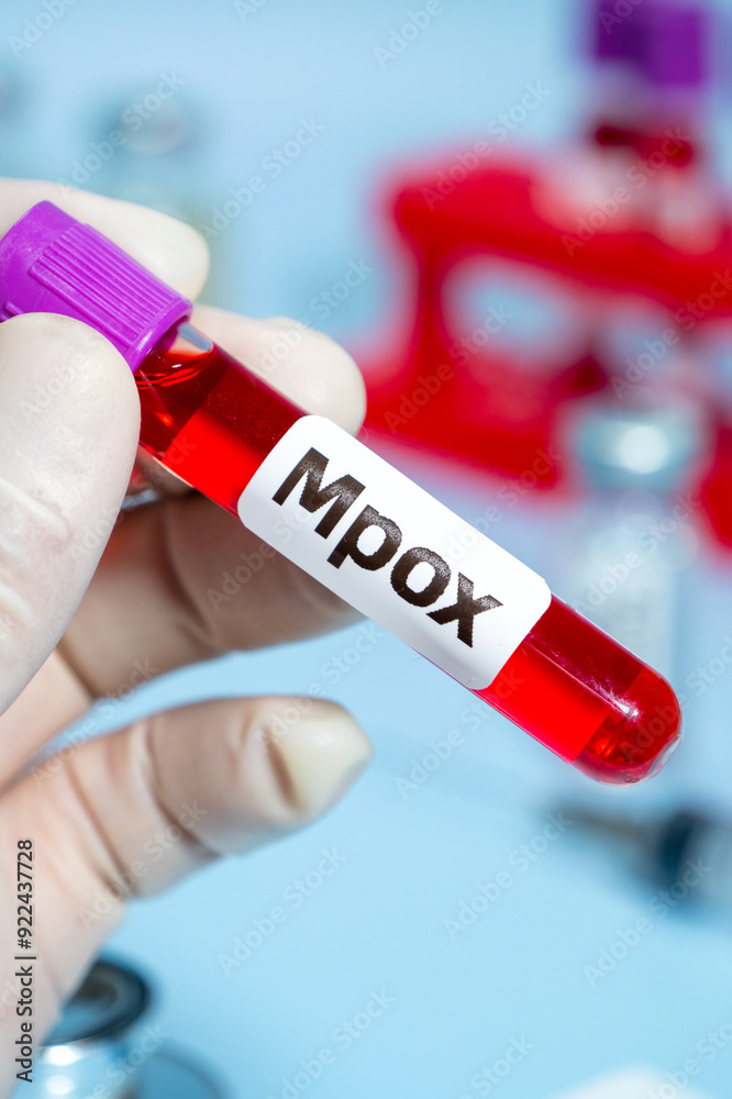 Obraz premium Blood collection tubes monkeypox test positive results,WHO to rename monkeypox as ‘MPOX’,vertical