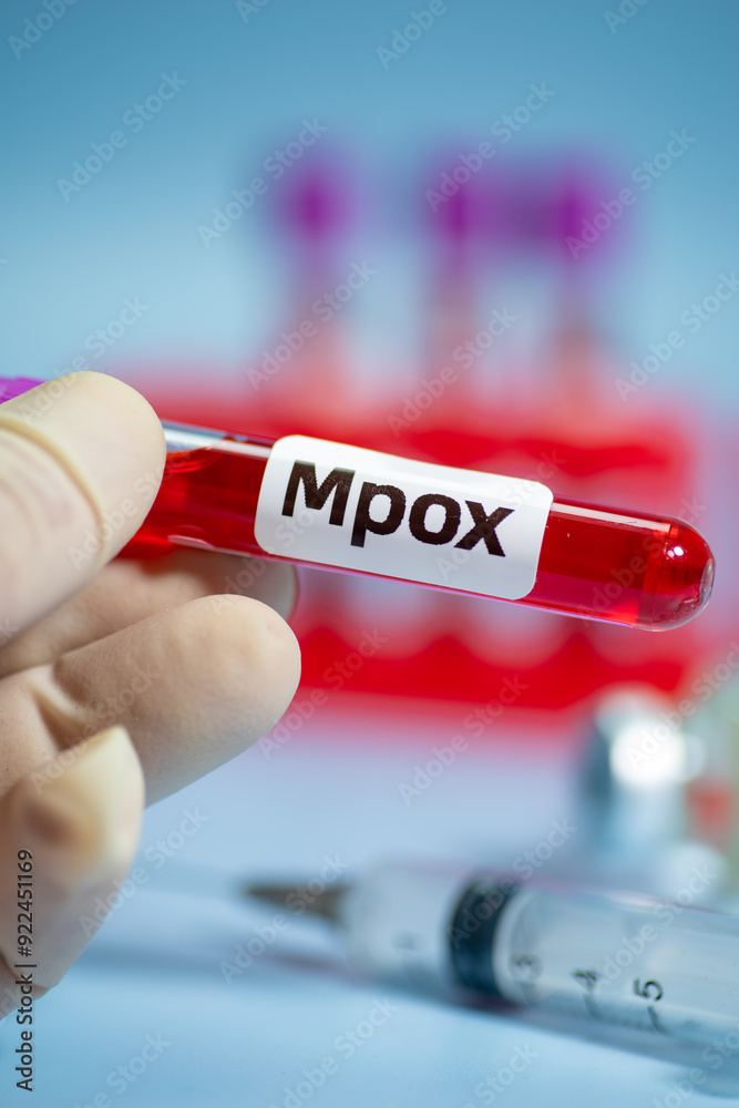 Fototapeta premium Blood collection tubes monkeypox test positive results,WHO to rename monkeypox as ‘MPOX’,vertical