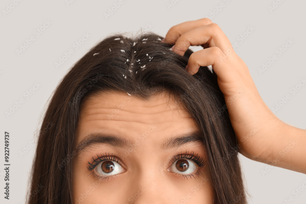 Naklejka premium Young woman with dandruff problem on white background, closeup