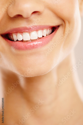 Foto Woman, mouth and teeth whitening smile in closeup, orthodontics and porcelain or invisible braces results