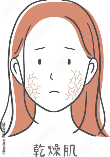 乾燥肌に悩む女性のイラスト素材