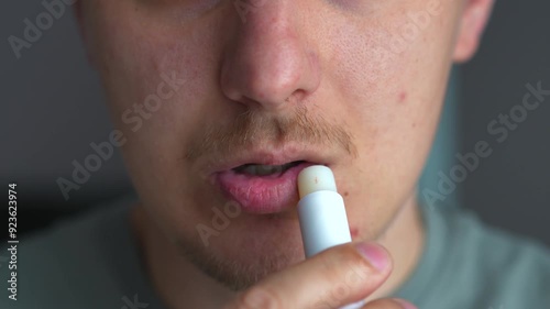 Lipstick.
Dry lips from the cold.
Cracked lips.
Body care