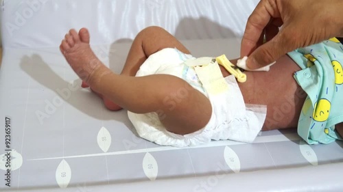 cleaning care and hygiene of the umbilical cord to a newborn baby in the hospital, with a gauze chlorhexidine soap and water. Neonate with clamp on the umbilical cord. high definition video photo