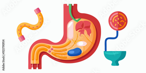 3D stomach vector set, esophagus icon kit, anatomy medical illustration, human internal organ. Sick abdomen, acid digestive ache, gastric digestive system on white. 3D stomach pain biology clipart