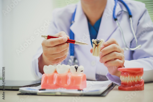 Dentures, dentures in the jaw, root canal treatment, gum disease, tooth models for dentists who are studying dentistry.