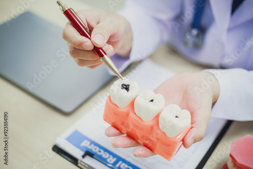 Dentures, dentures in the jaw, root canal treatment, gum disease, tooth models for dentists who are studying dentistry.