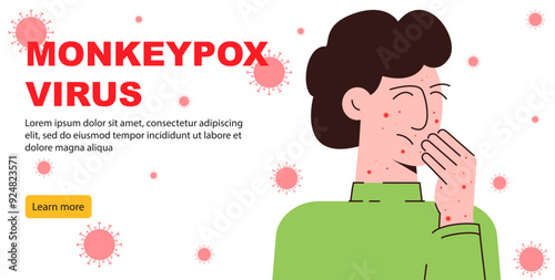 Danger of Mpox virus concept banner. Infected boy from monkey flat illustration. Monkeypox on human skin