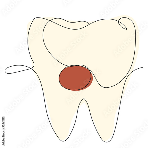 A diagram depicts a tooth with a distinct red area, representing a cavity, emphasizing the importance of dental care and awareness of tooth health.