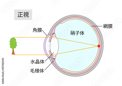 正常な目の見え方をあらわした目の断面図1