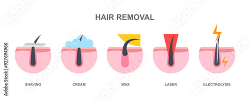 Procedure hair removal, main methods of hair removal: shaving, cream, wax, laser, electrolysis.