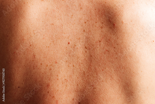 Detailed macro shot of skin surface, highlighting its natural imperfections and texture.