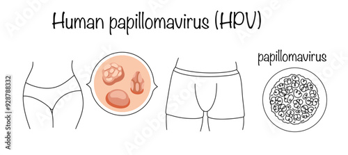 Human papillomavirus