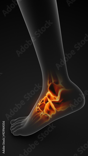 Chronic Ankle Joint Pain and Inflammation Syndrome