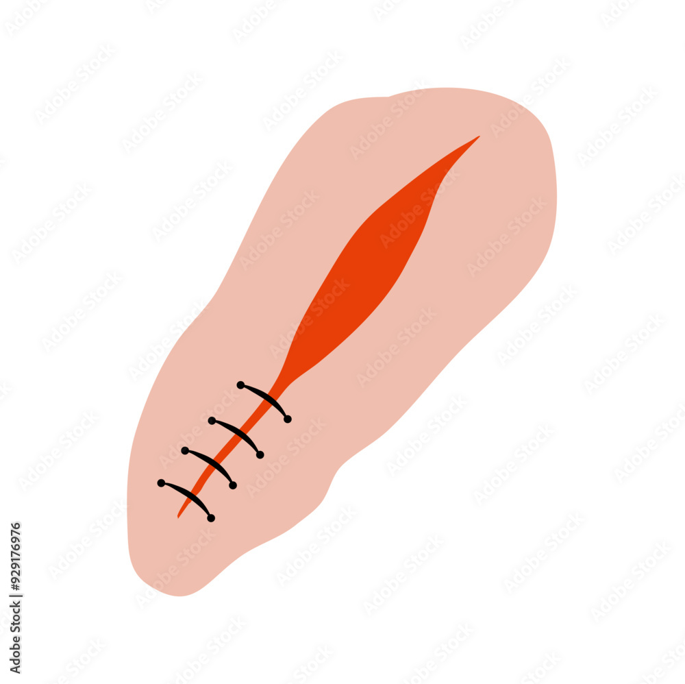 Cut suture scar vector icon. First aid injury stitch skin concept wound