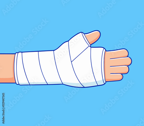 Broken arm, bone fracture, orthopedic cast. stock illustration