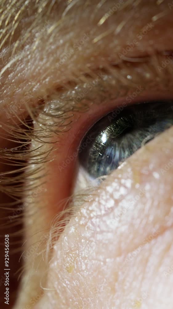 Gray Eye Opening Slowly Under Direct Light Gray Eye Opening Slowly Under Direct Light