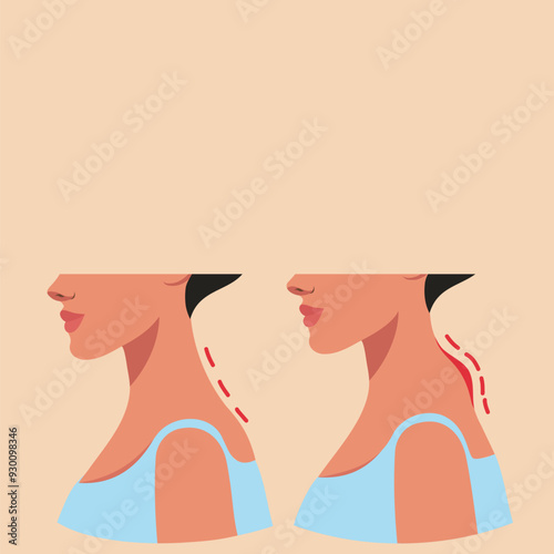 Taping. Remove the withers from the neck. Neck and body massage. Beautiful woman's face before and after massage. Vector illustration with place for advertising text, website, banner, posters, cover