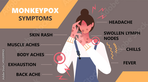 Monkeypox virus symptoms infographic poster. The symptoms of monkeypox such as fever, rash, headache, swollen lymph node, rashes on face, body and back, muscle aches.  Not AI generated