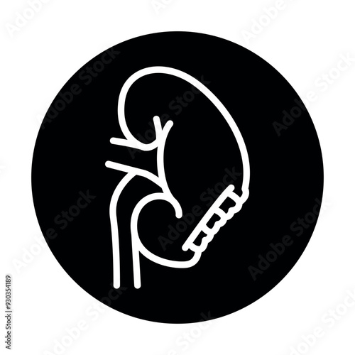 Nephrectomy black line icon. Operations on the abdominal cavity.