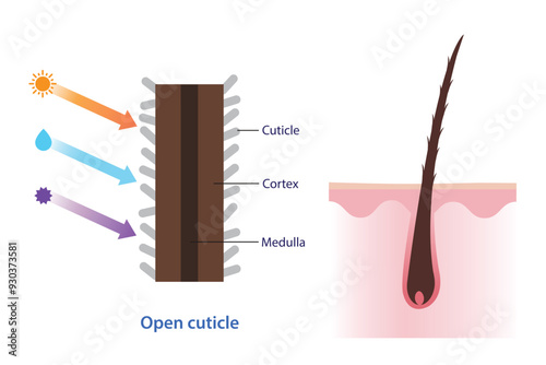 Cross section of open hair cuticle vector illustration. Structure of damaged, dry, frizzy hair on scalp layer caused by ultraviolet, heat, moisture and toxic product. Hair care and anatomy concept.