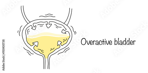 Bladder hyperactivity